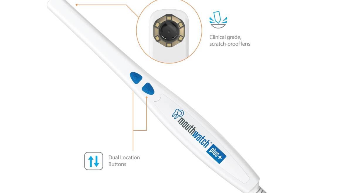 MouthWatch Intraoral Camera Comparison